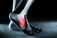 Symptoms of Tarsal Tunnel Syndrome